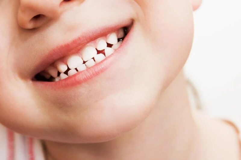 2899 more Newcastle children seen by an NHS Dentist